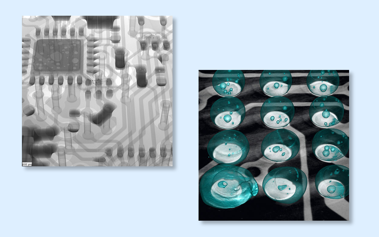 4. 2D vs 3D CT X-ray Which One Do You Really Need? 4. 2D или 3D КТ-рентген. Какой из них вам действительно нужен?