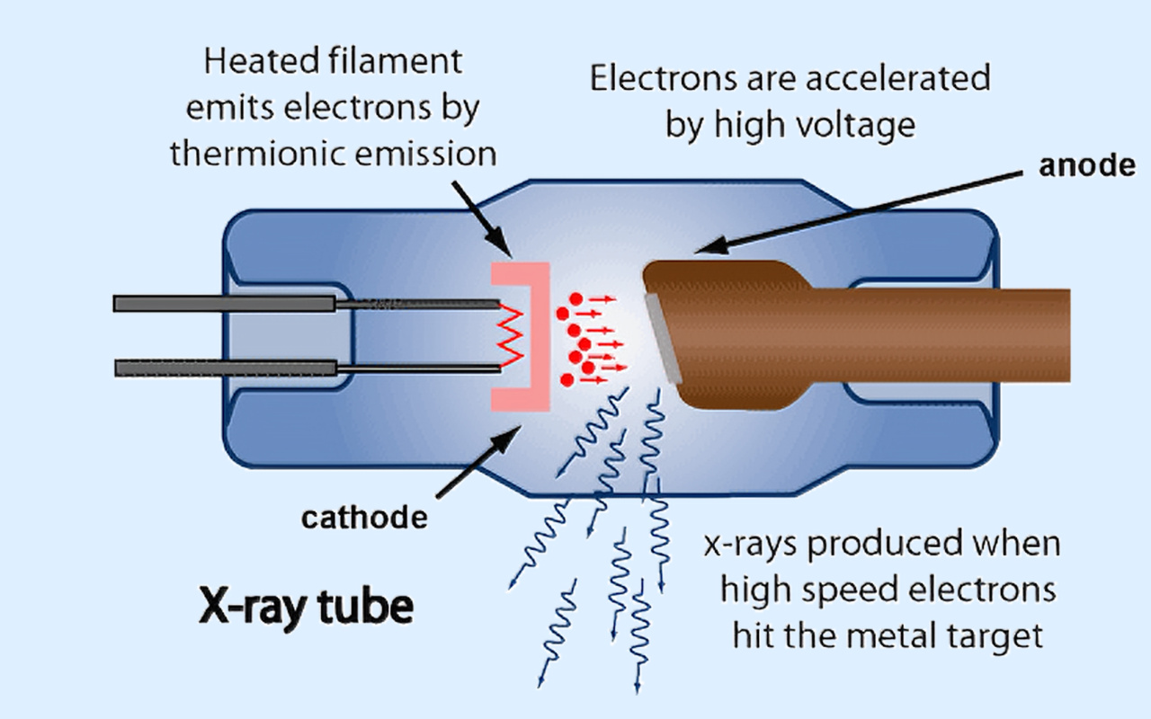 2. What X-ray Technology Actually Does 2. Что на самом деле делает рентгеновская технология